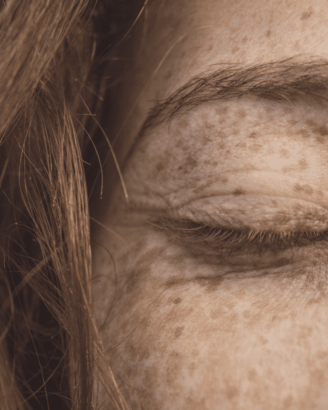 Article : Unreine Haut: 6 Schritte für ein reines Hautbild